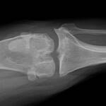 Knee X-Ray of Annie the Boxer